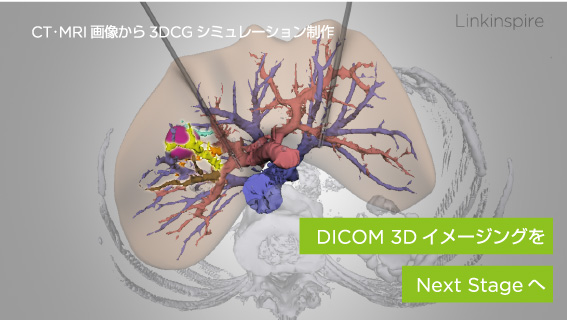 CT･MRI 画像から 3DCG シミュレーション制作