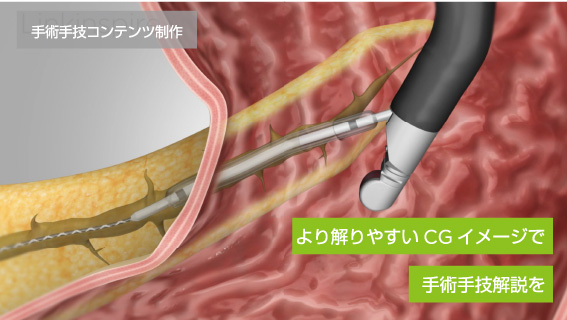 手術手技コンテンツ制作